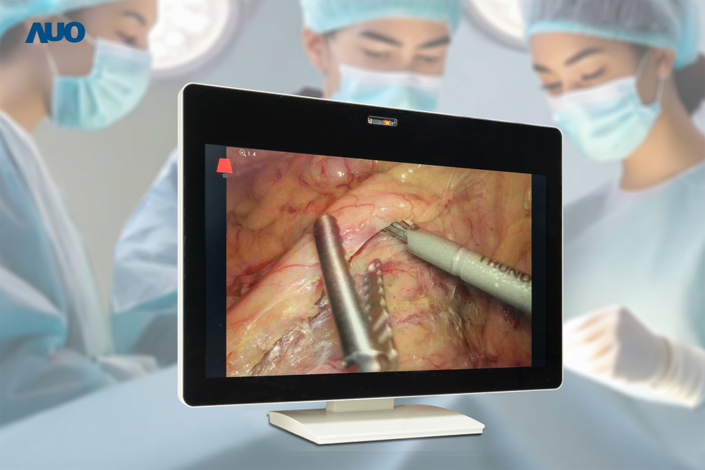 FUN88樂天佈局智慧醫療場域，開發裸眼3D醫療顯示器，協助醫療團隊在手術過程中無需佩戴3D眼鏡，即能清晰觀看3D影像，同時提升手術溝通效率及舒適感  